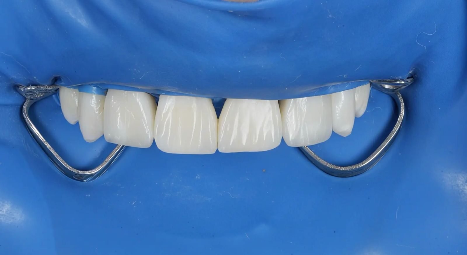 Patient Case