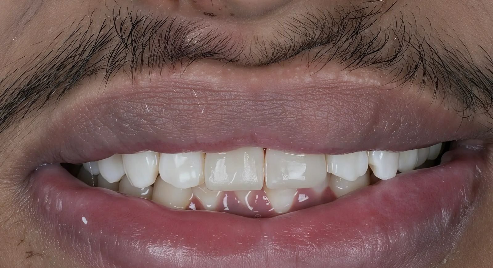 Patient Case