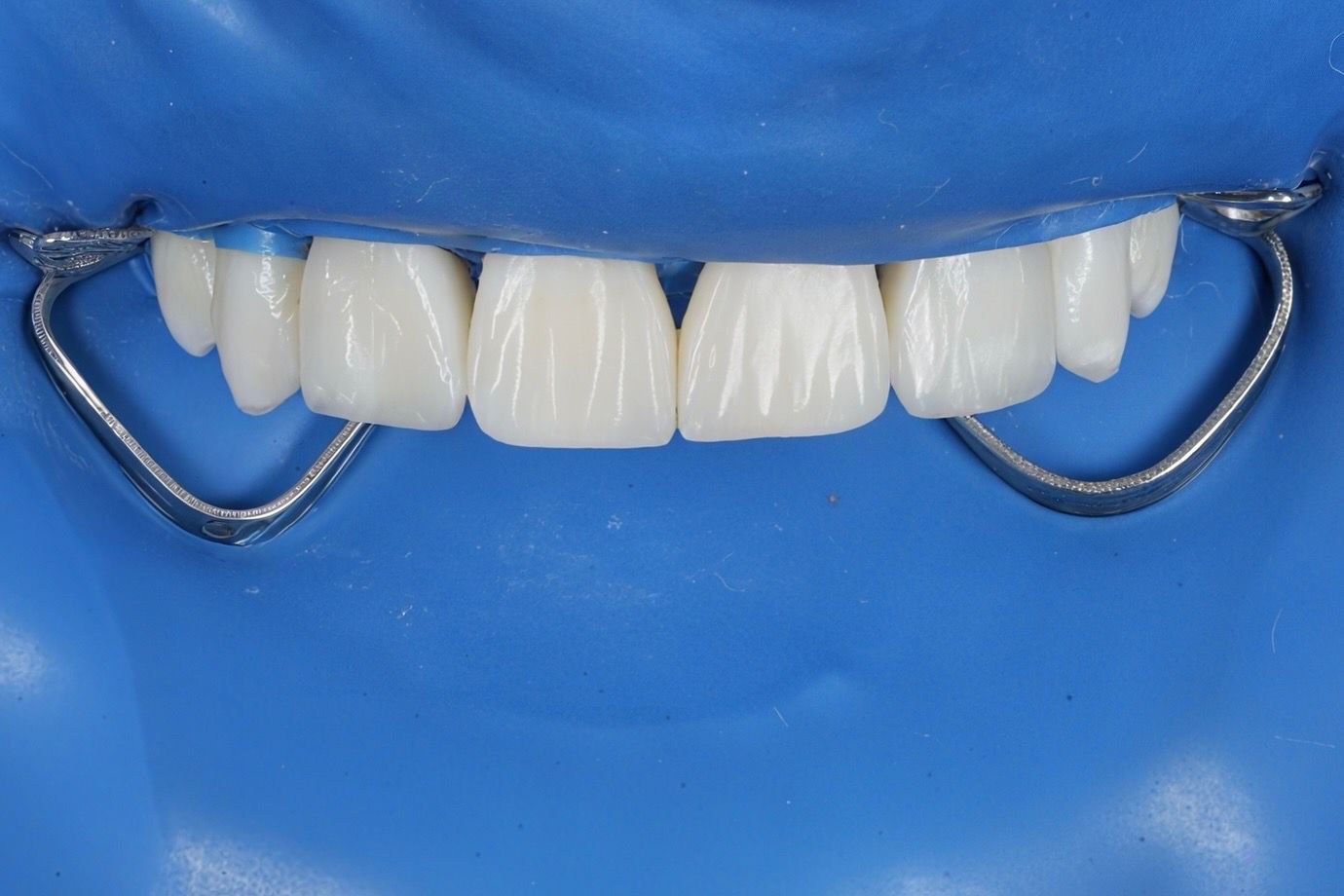 Patient Case