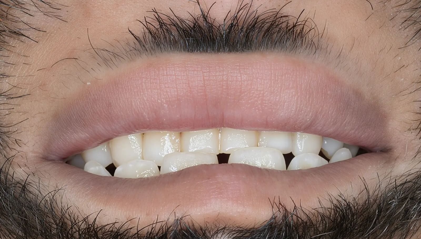 Patient Case