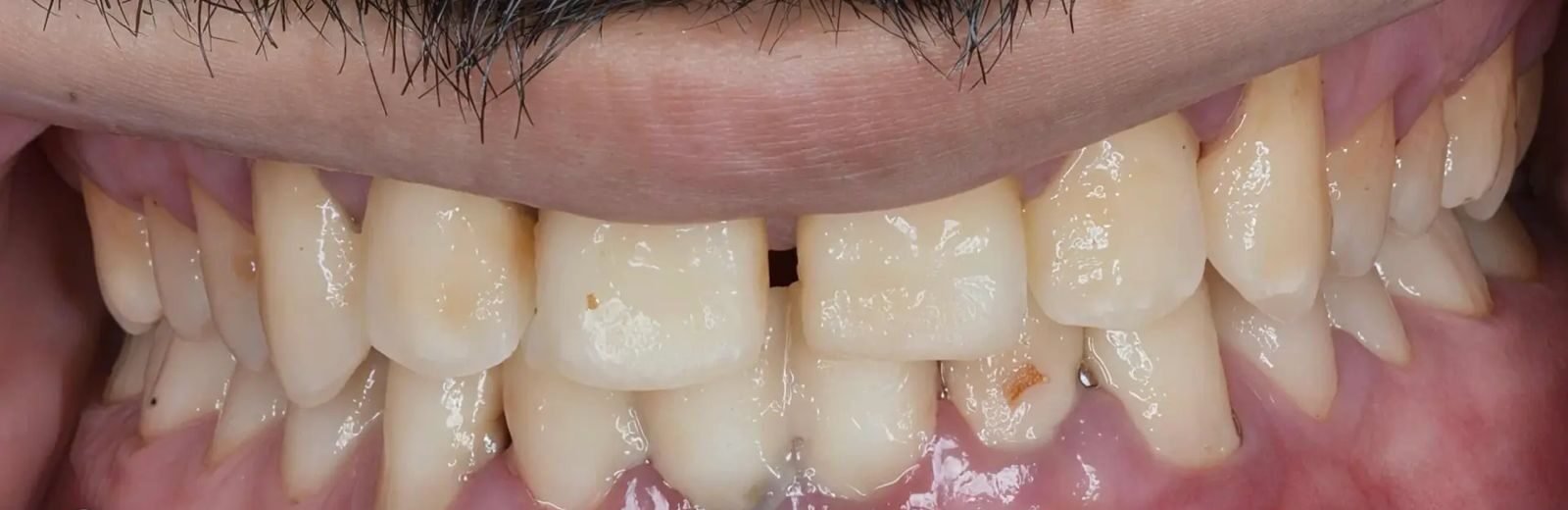 Patient Case