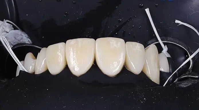 Patient Case