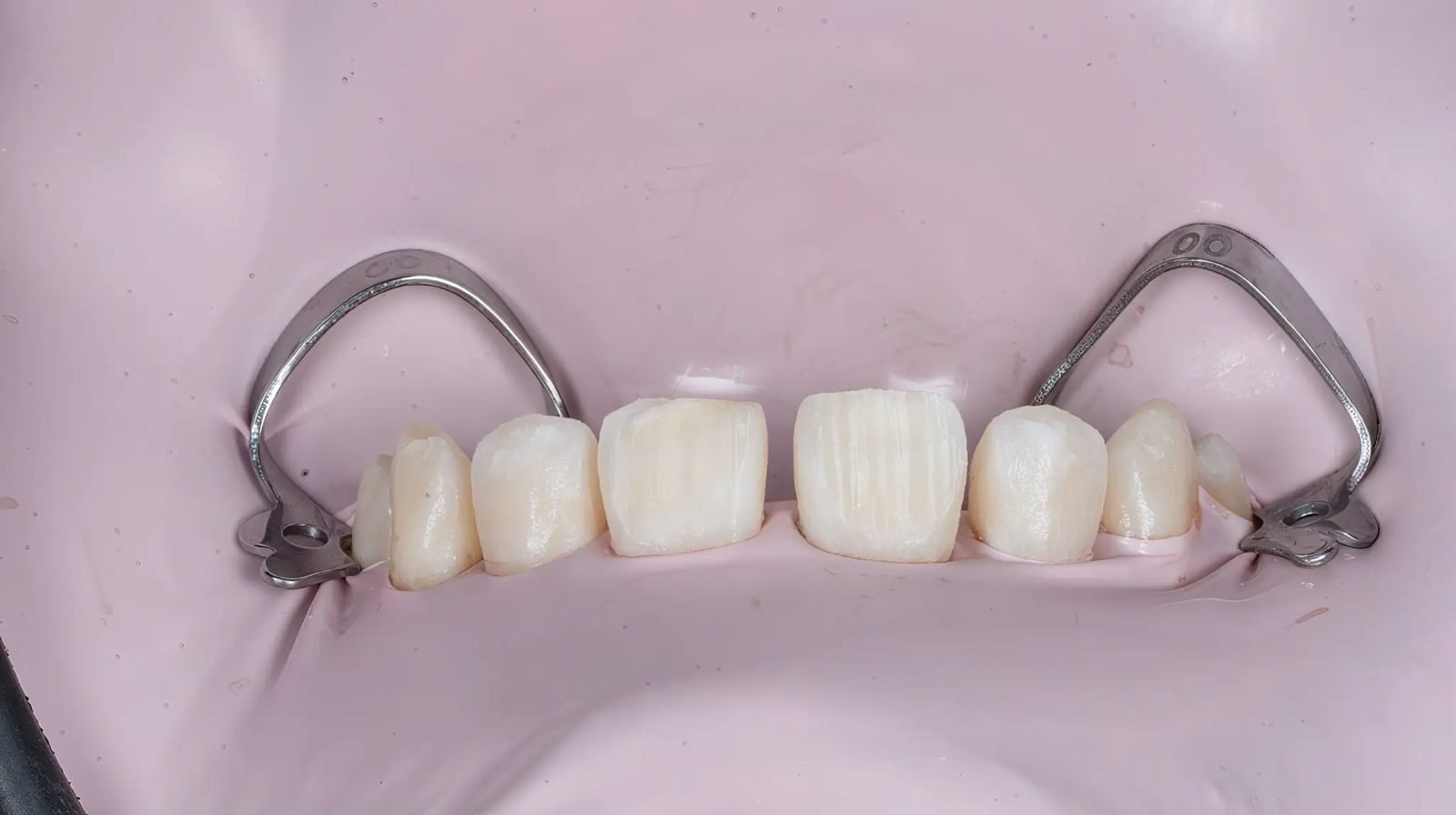 Patient Case