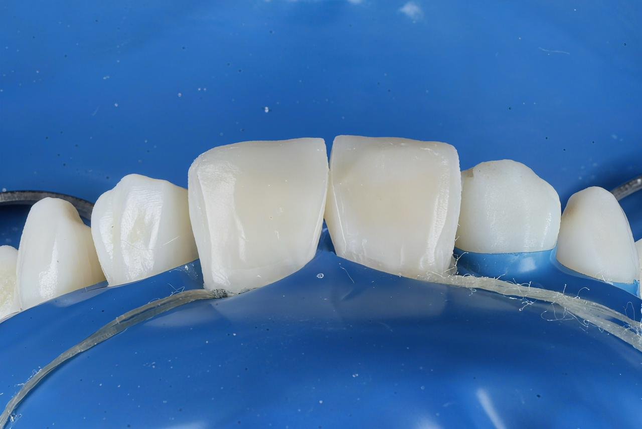 Patient Case