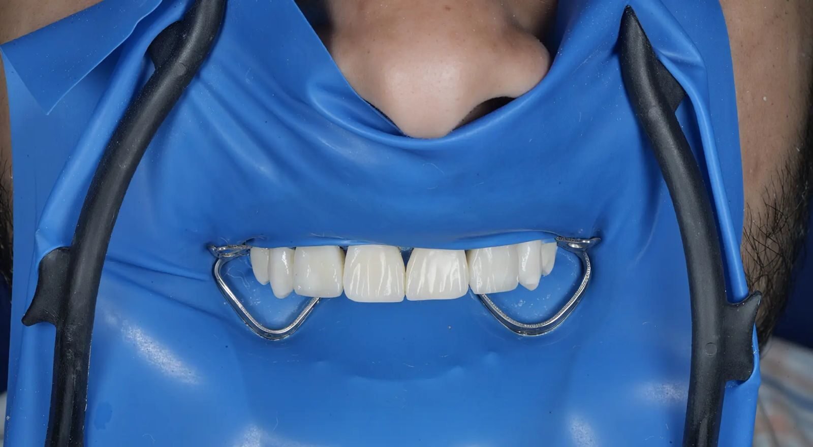 Patient Case