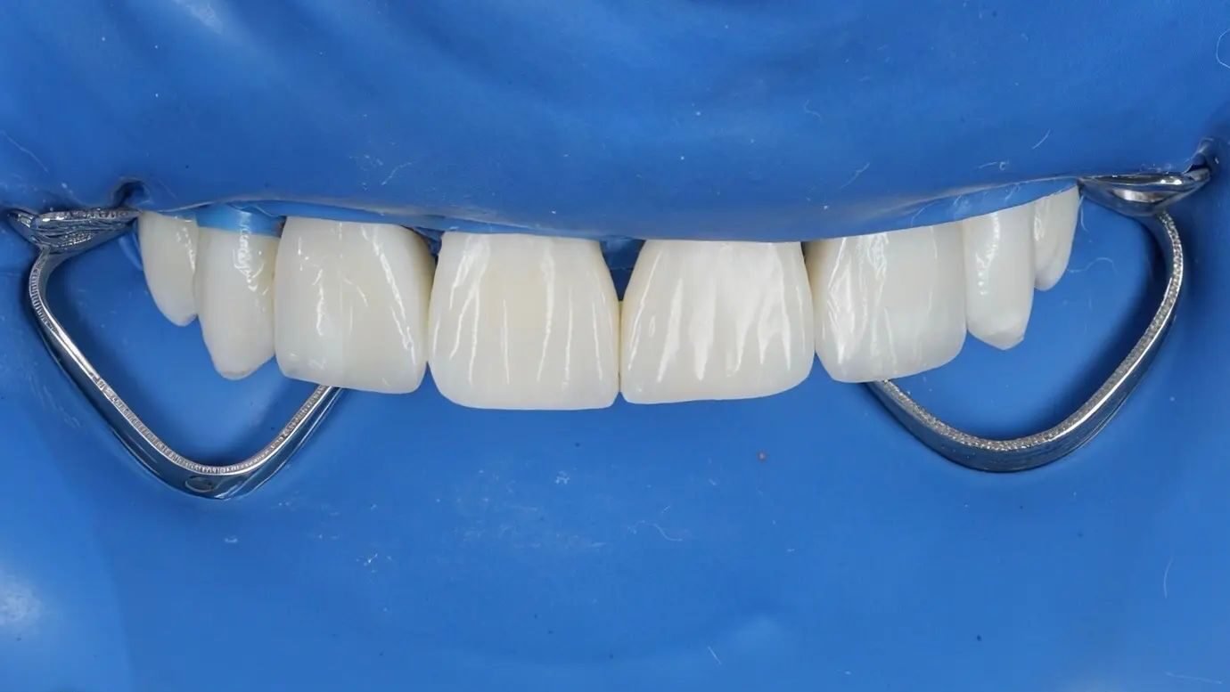 Patient Case