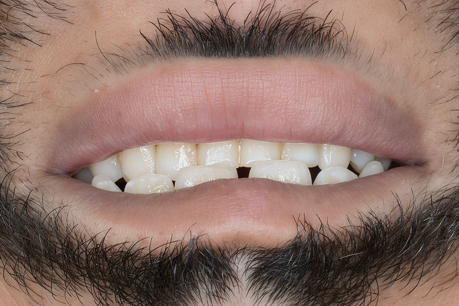 Patient Case