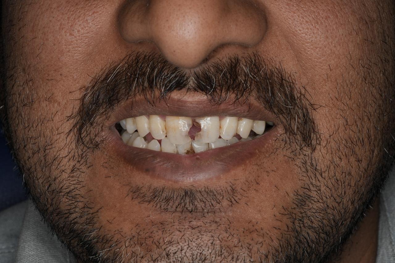 Patient Case