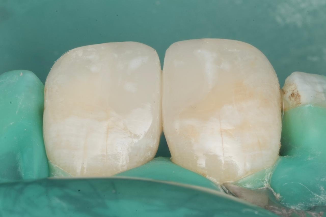 Patient Case