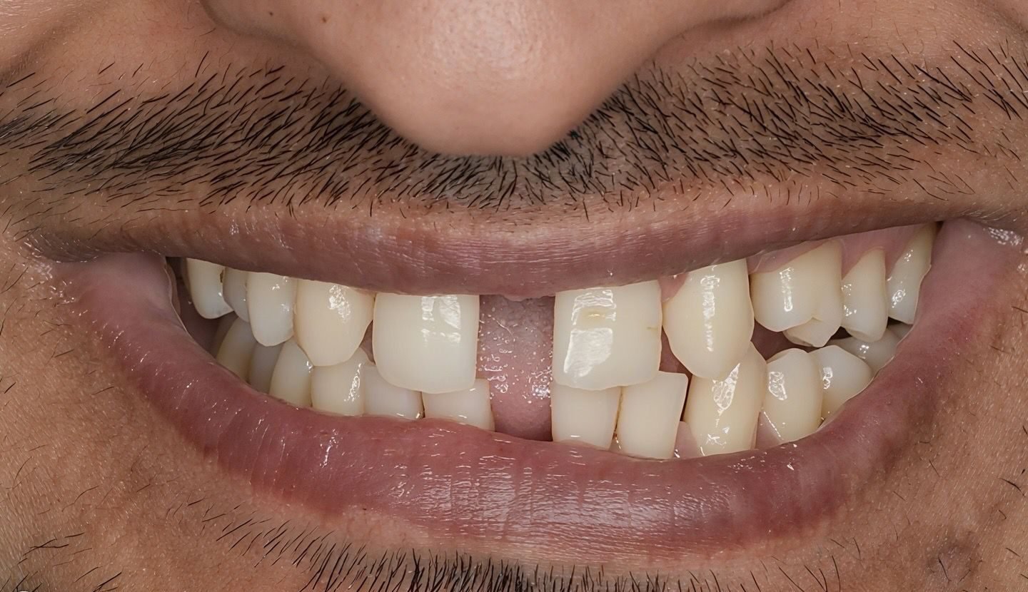 Patient Case