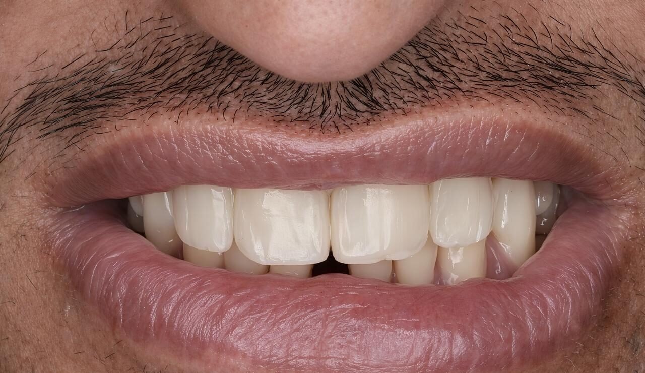 Patient Case