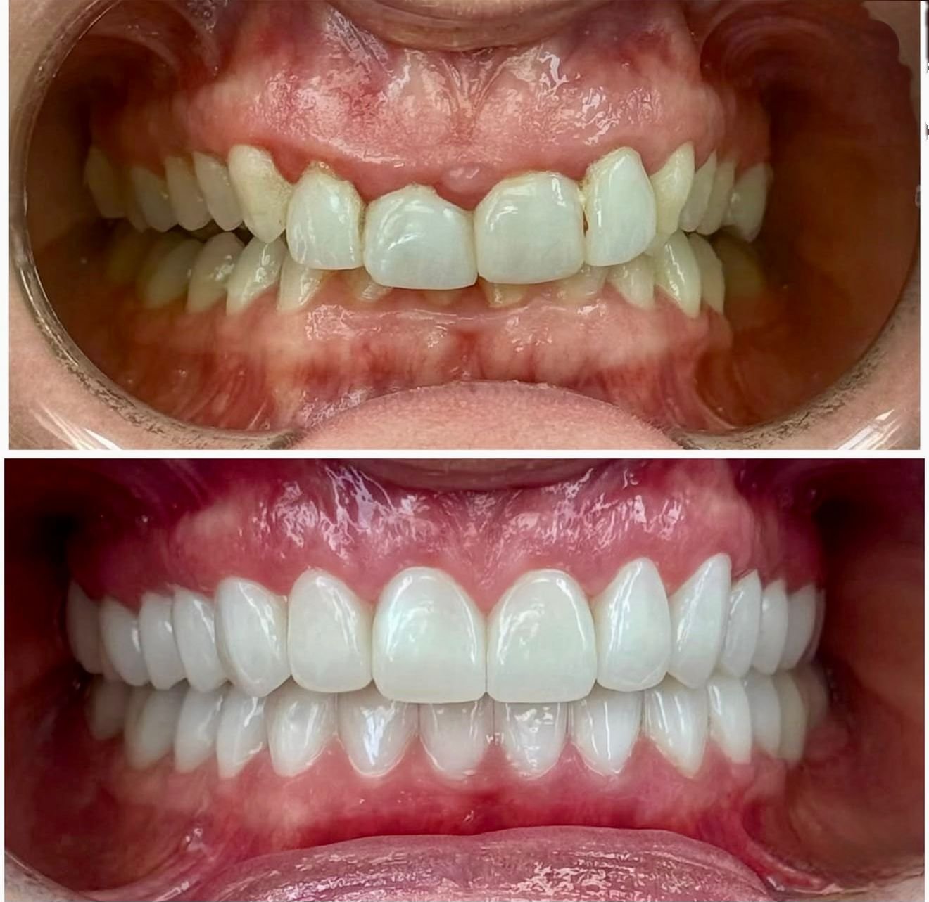 Patient Case