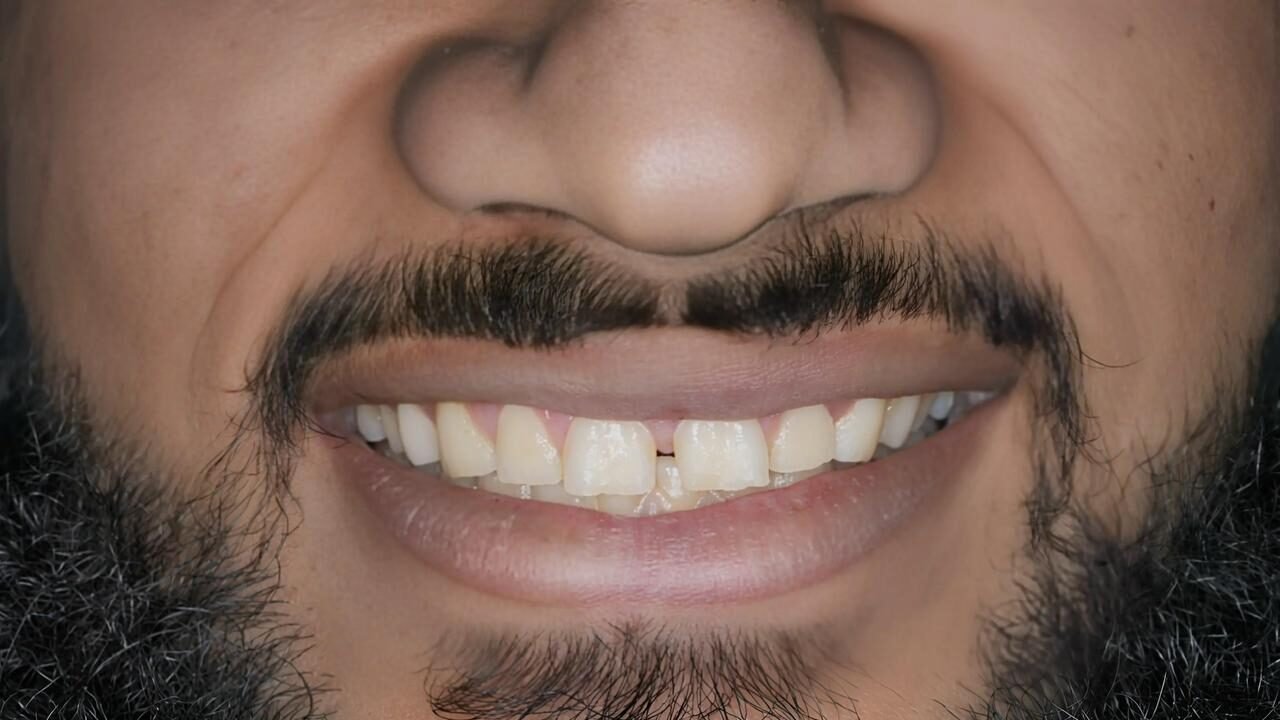 Patient Case