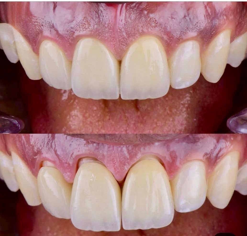 Patient Case