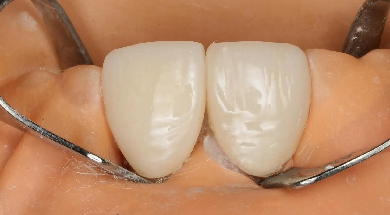 Patient Case