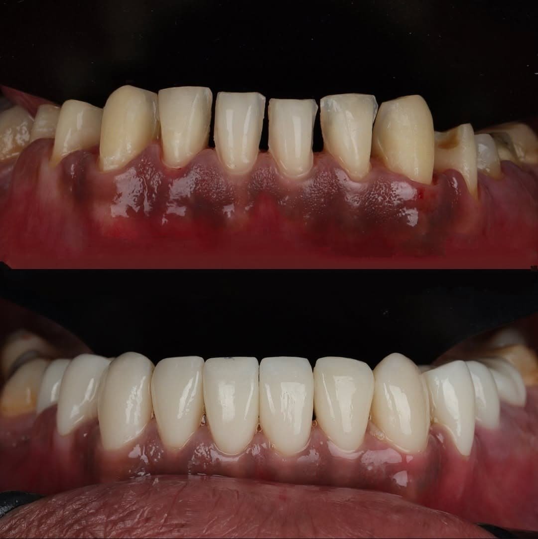 Patient Case