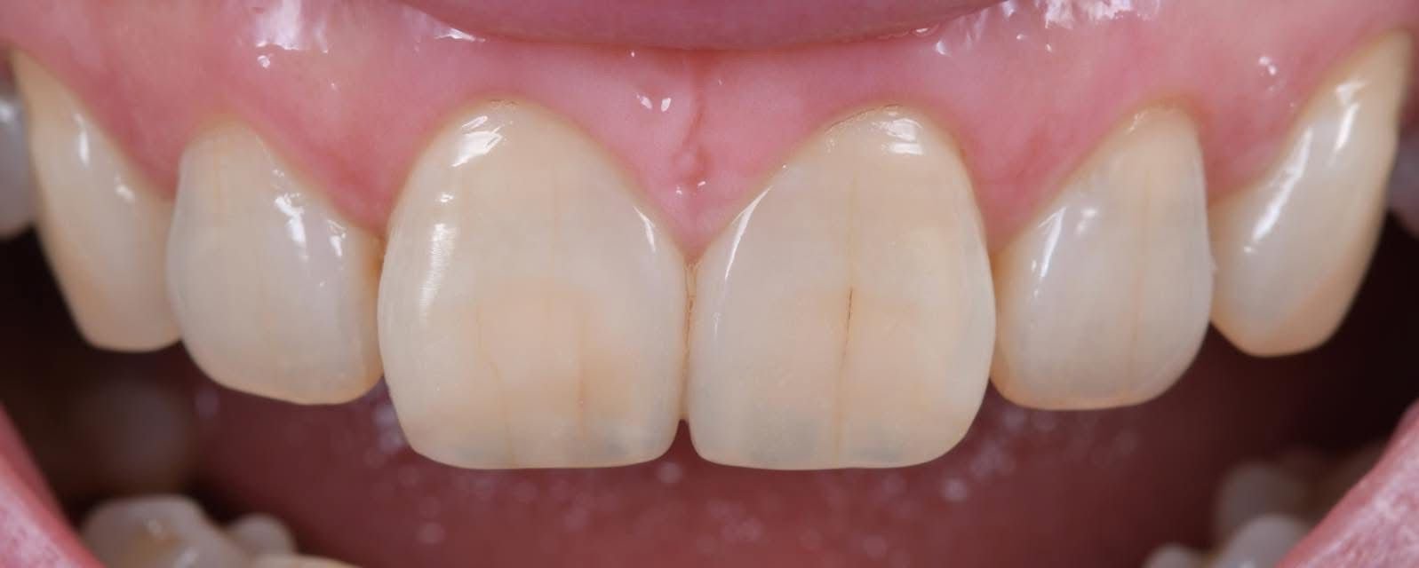 Patient Case