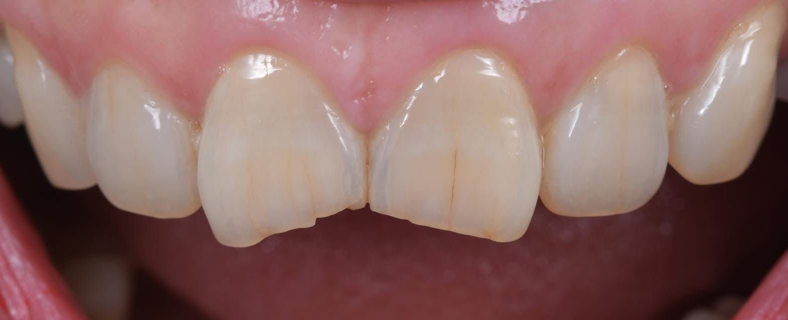 Patient Case
