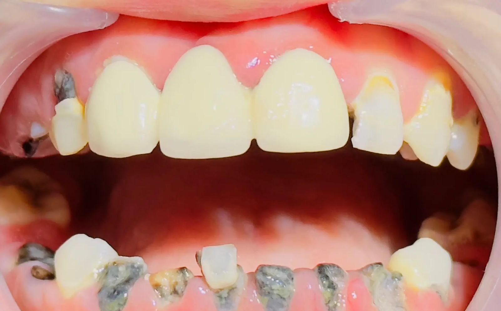 Patient Case