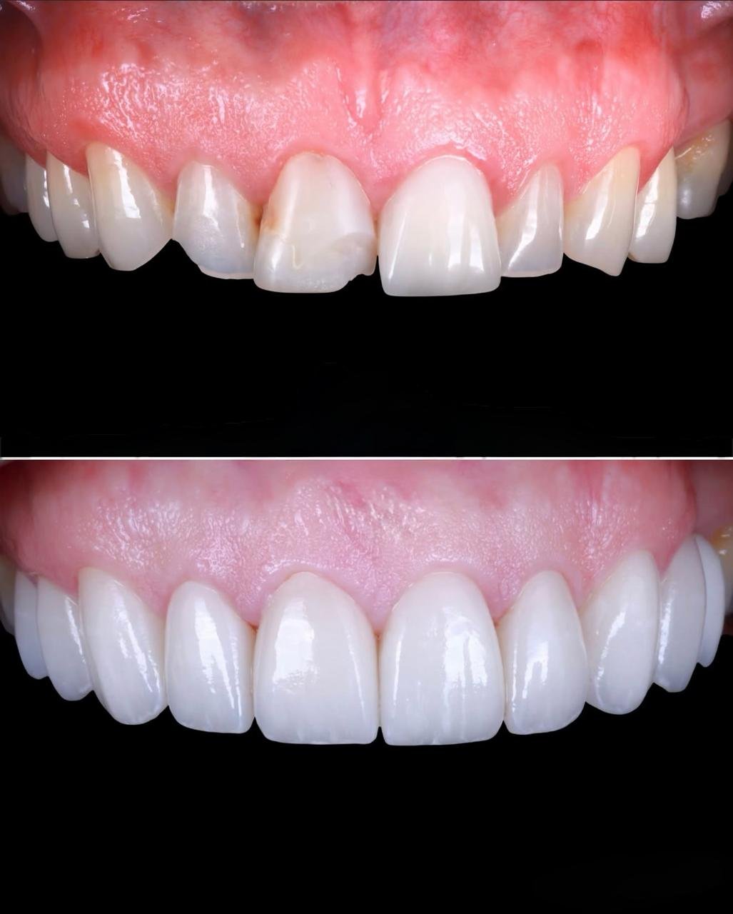 Patient Case