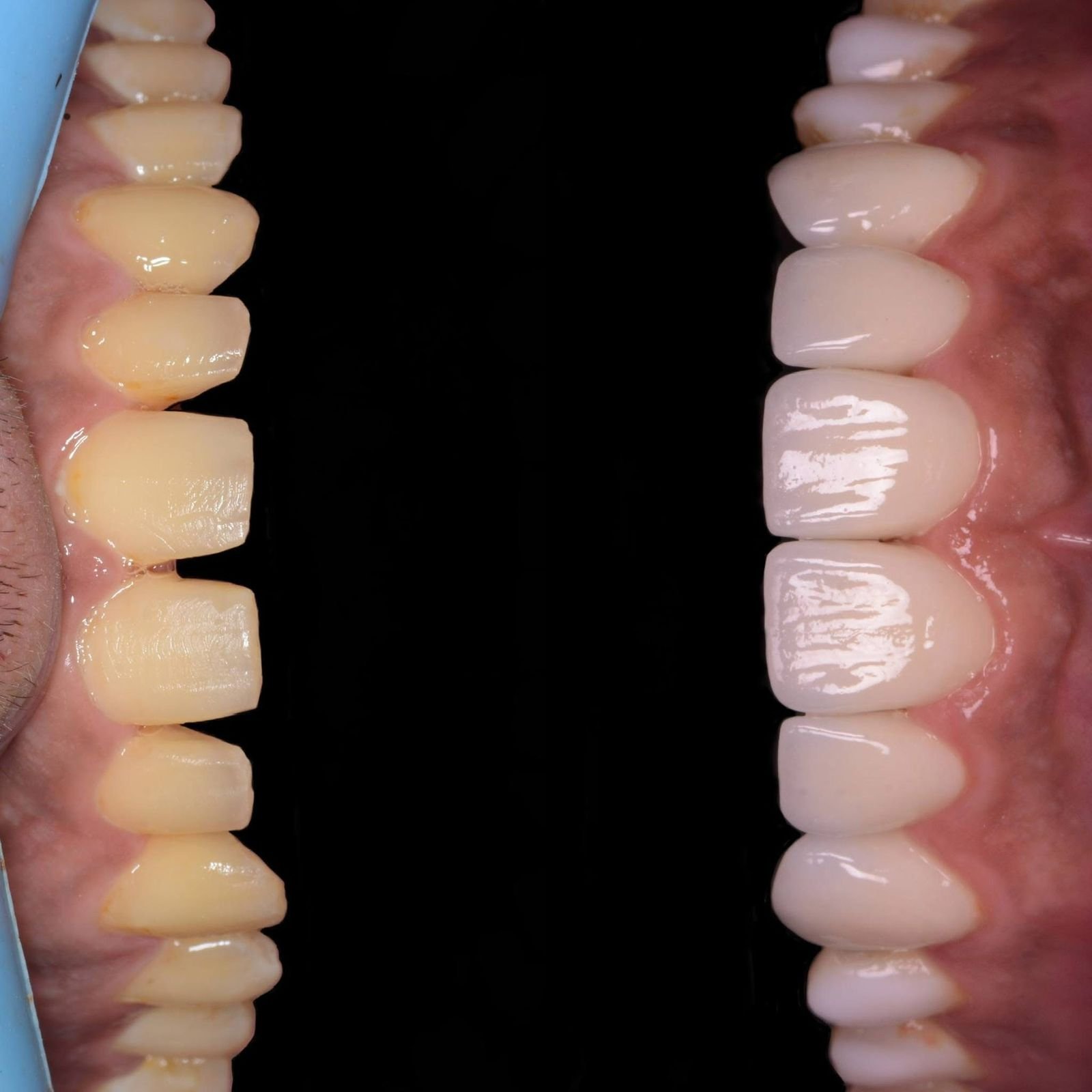 Patient Case