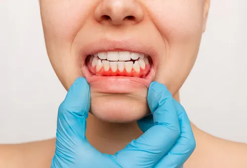 Dental Checkup