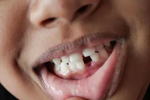 Children's Dentistry