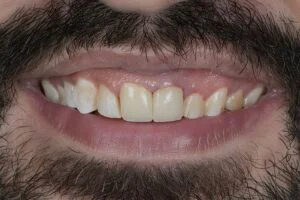 Patient Case