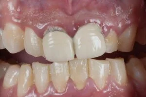 Patient Case