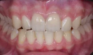 Patient Case