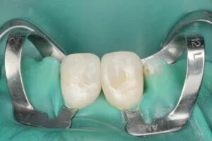 Patient Case