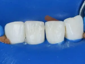 Patient Case