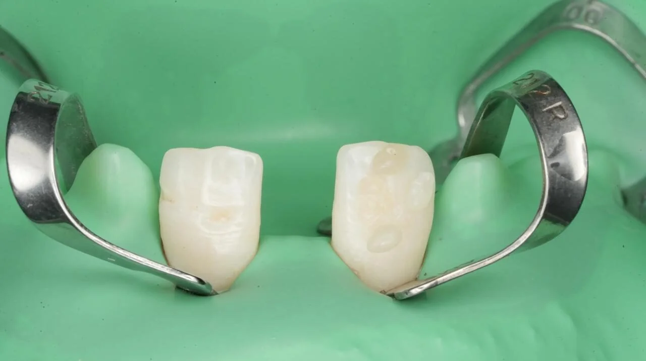 Patient Case