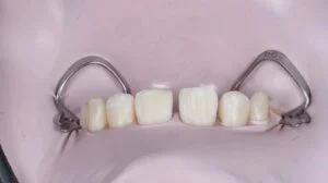 Patient Case