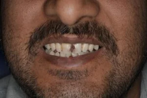 Patient Case