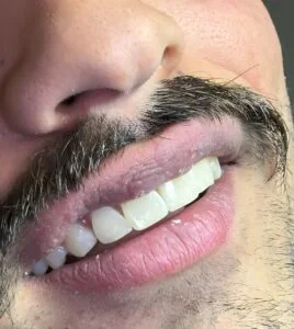 Patient Case