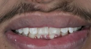 Patient Case