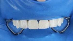 Patient Case