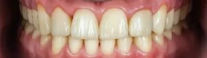 Patient Case