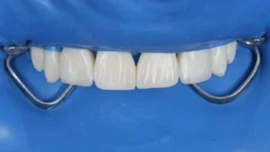 Patient Case