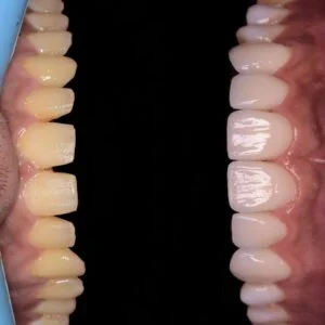 Patient Case