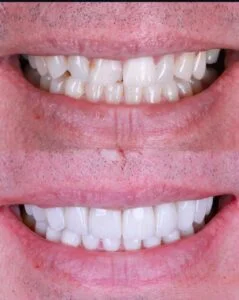 Patient Case
