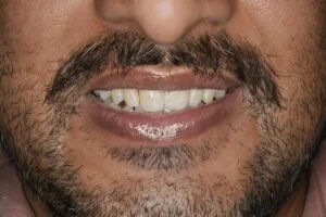 Patient Case