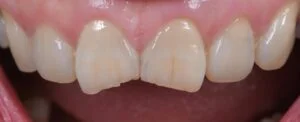 Patient Case