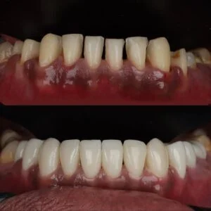 Patient Case