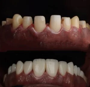 Patient Case