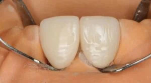 Patient Case