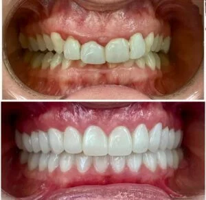 Patient Case