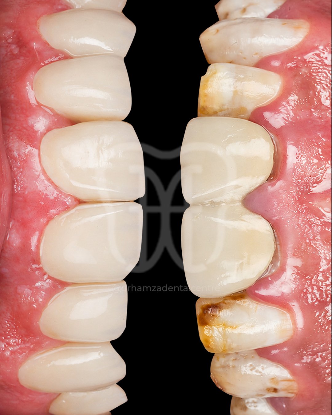 Patient Case