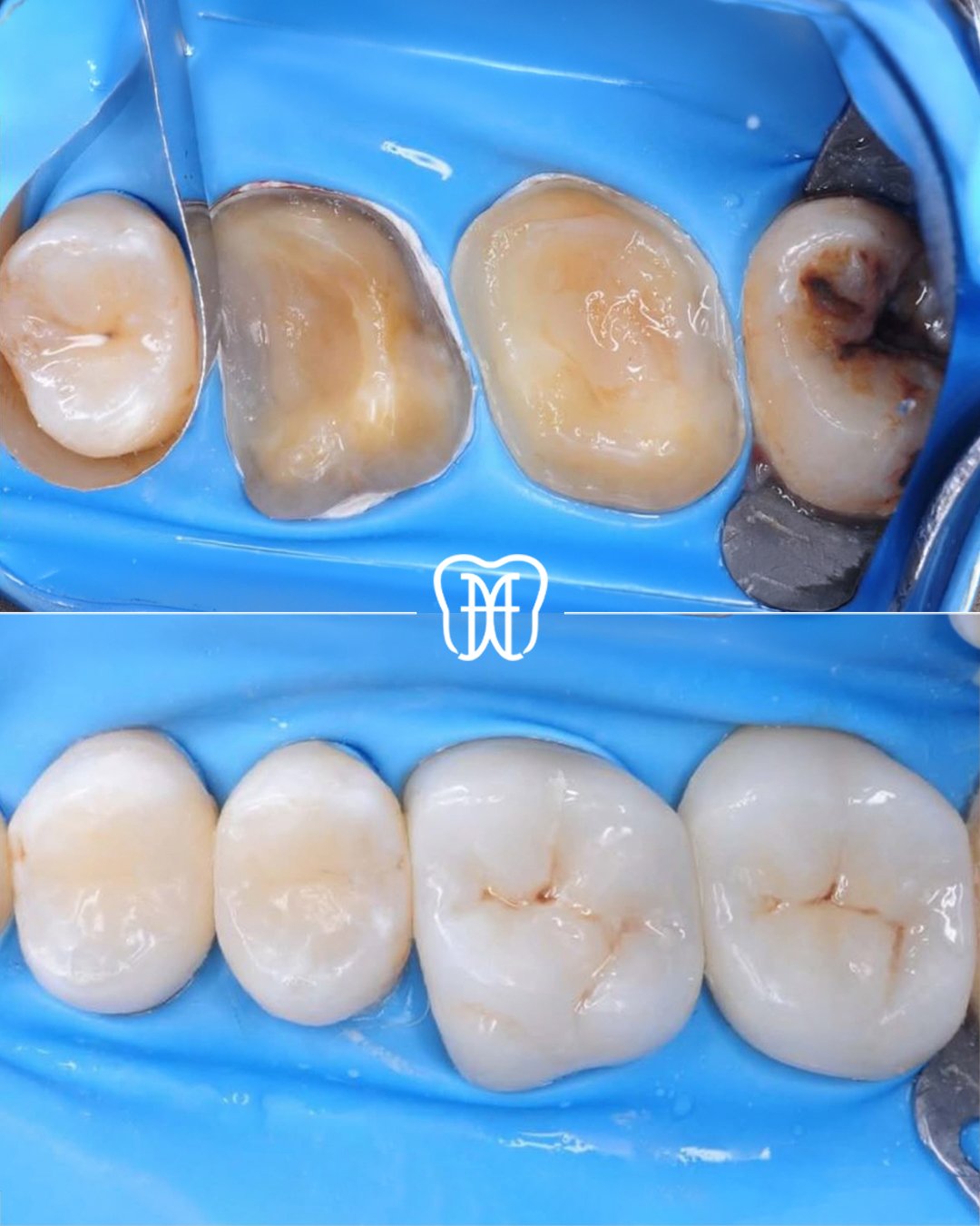 Patient Case